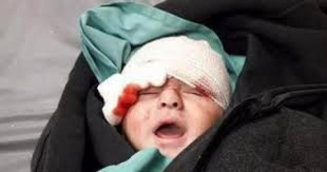 طفل شهيد ضحية البربرية الإسرائيلية