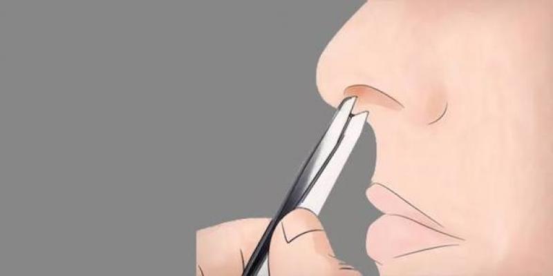 شعر الأنف